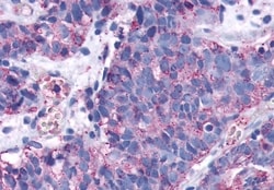 EDG3 Polyclonal Antibody:Antibodies, Polyclonal