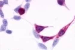 Invitrogen Endothelin B Receptor Polyclonal Antibody 50 &mu;g; Unconjugated:Antibodies,