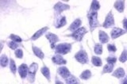 Invitrogen Endothelin B Receptor Polyclonal Antibody 50 &mu;g; Unconjugated:Antibodies,