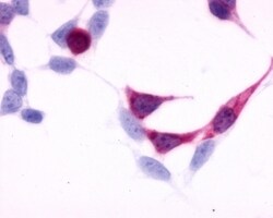 Invitrogen Endothelin B Receptor Polyclonal Antibody 50 &mu;g; Unconjugated:Antibodies,