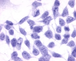 Invitrogen Endothelin B Receptor Polyclonal Antibody 50 &mu;g; Unconjugated:Antibodies,
