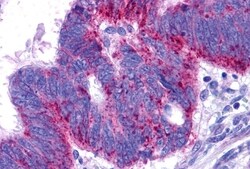 Invitrogen Endothelin B Receptor Polyclonal Antibody 50 &mu;g; Unconjugated:Antibodies,