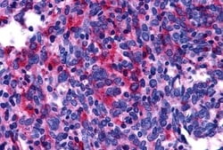 Invitrogen Endothelin B Receptor Polyclonal Antibody 50 &mu;g; Unconjugated:Antibodies,