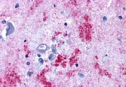 Invitrogen Endothelin B Receptor Polyclonal Antibody 50 &mu;g; Unconjugated:Antibodies,