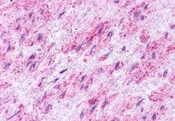 Invitrogen Endothelin B Receptor Polyclonal Antibody 50 &mu;g; Unconjugated:Antibodies,