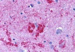 Invitrogen Endothelin B Receptor Polyclonal Antibody 50 &mu;g; Unconjugated:Antibodies,