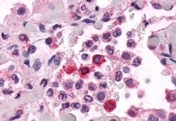 Invitrogen EMR2 Polyclonal Antibody 50 &mu;g | Buy Online | Invitrogen&trade; | Fisher Scientific