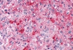 Invitrogen EMR2 Polyclonal Antibody 50 &mu;g | Buy Online | Invitrogen&trade; | Fisher Scientific