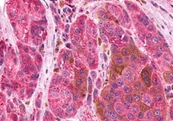 Invitrogen EMR2 Polyclonal Antibody 50 &mu;g | Buy Online | Invitrogen&trade; | Fisher Scientific