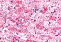 Invitrogen EMR2 Polyclonal Antibody 50 &mu;g | Buy Online | Invitrogen&trade; | Fisher Scientific