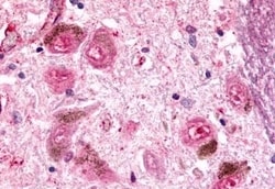 Invitrogen EMR2 Polyclonal Antibody 50 &mu;g | Buy Online | Invitrogen&trade; | Fisher Scientific