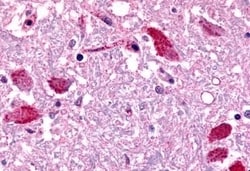 Invitrogen EMR2 Polyclonal Antibody 50 &mu;g | Buy Online | Invitrogen&trade; | Fisher Scientific