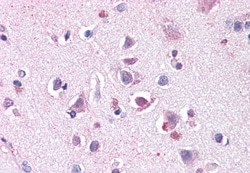 Invitrogen ENT1 Polyclonal Antibody 50 &mu;g; Unconjugated:Antibodies,