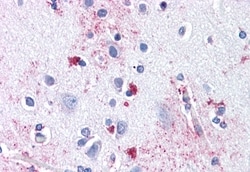 Invitrogen ENT1 Polyclonal Antibody 50 &mu;g; Unconjugated:Antibodies,