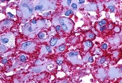 Invitrogen PTGER2 Polyclonal Antibody 50 &mu;g; Unconjugated:Antibodies,