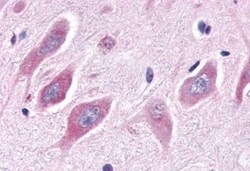 Invitrogen ESRRA Polyclonal Antibody 50 &mu;g; Unconjugated:Antibodies,