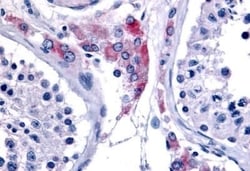Invitrogen ESRRB Polyclonal Antibody 50 &mu;g; Unconjugated:Antibodies,