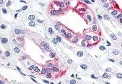 ESRRG Polyclonal Antibody:Antibodies, Polyclonal