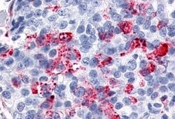 ESRRG Polyclonal Antibody:Antibodies, Polyclonal