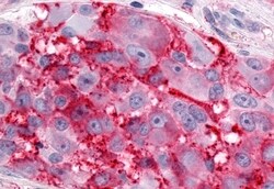 ESRRG Polyclonal Antibody:Antibodies, Polyclonal