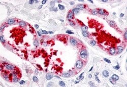ESRRG Polyclonal Antibody:Antibodies, Polyclonal