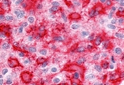 ESRRG Polyclonal Antibody:Antibodies, Polyclonal