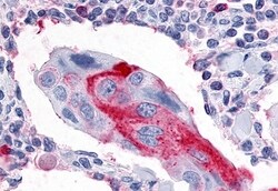 ESRRG Polyclonal Antibody:Antibodies, Polyclonal