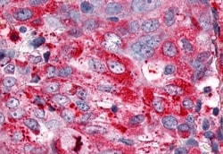 ESRRG Polyclonal Antibody:Antibodies, Polyclonal