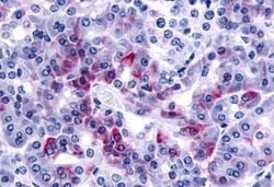 Invitrogen PAR2 Polyclonal Antibody 50 &mu;g | Buy Online | Invitrogen&trade; | Fisher Scientific