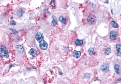 Invitrogen PAR2 Polyclonal Antibody 50 &mu;g | Buy Online | Invitrogen&trade; | Fisher Scientific