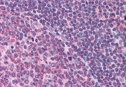 Invitrogen FPR1 Polyclonal Antibody 50 &mu;g | Buy Online | Invitrogen&trade; | Fisher Scientific