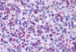 Invitrogen FPR1 Polyclonal Antibody 50 &mu;g | Buy Online | Invitrogen&trade; | Fisher Scientific