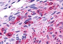 Invitrogen Frizzled-2 Polyclonal Antibody 50 &mu;g; Unconjugated:Antibodies,