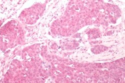 Invitrogen Frizzled-2 Polyclonal Antibody 50 &mu;g; Unconjugated:Antibodies,