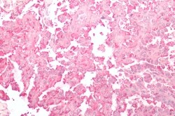 Invitrogen Frizzled-2 Polyclonal Antibody 50 &mu;g; Unconjugated:Antibodies,