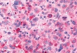 Invitrogen FZD6 Polyclonal Antibody 50 &mu;g; Unconjugated:Antibodies,