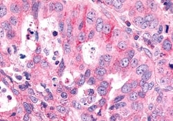 Invitrogen FZD6 Polyclonal Antibody 50 &mu;g; Unconjugated:Antibodies,