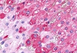 FSHR Polyclonal Antibody:Antibodies, Polyclonal