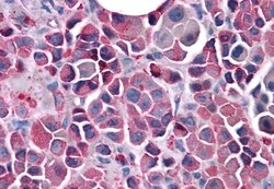 Invitrogen FZD3 Polyclonal Antibody 50 &mu;g | Buy Online | Invitrogen&trade; | Fisher Scientific