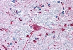 Invitrogen FZD3 Polyclonal Antibody 50 &mu;g | Buy Online | Invitrogen&trade; | Fisher Scientific