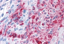 Invitrogen FZD3 Polyclonal Antibody 50 &mu;g | Buy Online | Invitrogen&trade; | Fisher Scientific