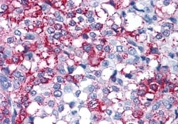 Invitrogen FZD3 Polyclonal Antibody 50 &mu;g | Buy Online | Invitrogen&trade; | Fisher Scientific