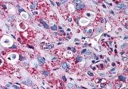 Invitrogen FZD3 Polyclonal Antibody 50 &mu;g | Buy Online | Invitrogen&trade; | Fisher Scientific