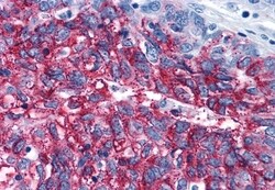 Invitrogen FZD3 Polyclonal Antibody 50 &mu;g | Buy Online | Invitrogen&trade; | Fisher Scientific