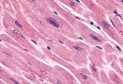 Invitrogen FZD7 Polyclonal Antibody 50 &mu;g; Unconjugated:Antibodies,