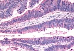 Invitrogen FZD7 Polyclonal Antibody 50 &mu;g; Unconjugated:Antibodies,