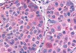 Invitrogen FZD7 Polyclonal Antibody 50 &mu;g; Unconjugated:Antibodies,