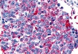 Invitrogen FZD8 Polyclonal Antibody 50 &mu;g; Unconjugated:Antibodies,