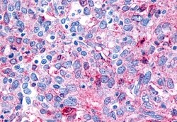 Invitrogen FZD8 Polyclonal Antibody 50 &mu;g; Unconjugated:Antibodies,