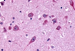 FZD8 Polyclonal Antibody:Antibodies, Polyclonal